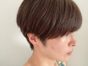 顔ほくろはとるべき？除去方法・痕・チャームポイントになるかを徹底解説