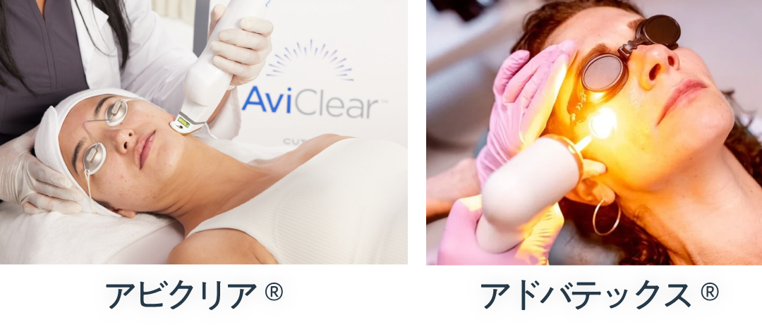 ニキビ痕のドブ金治療とは？裏情報も踏まえた成功する治療法