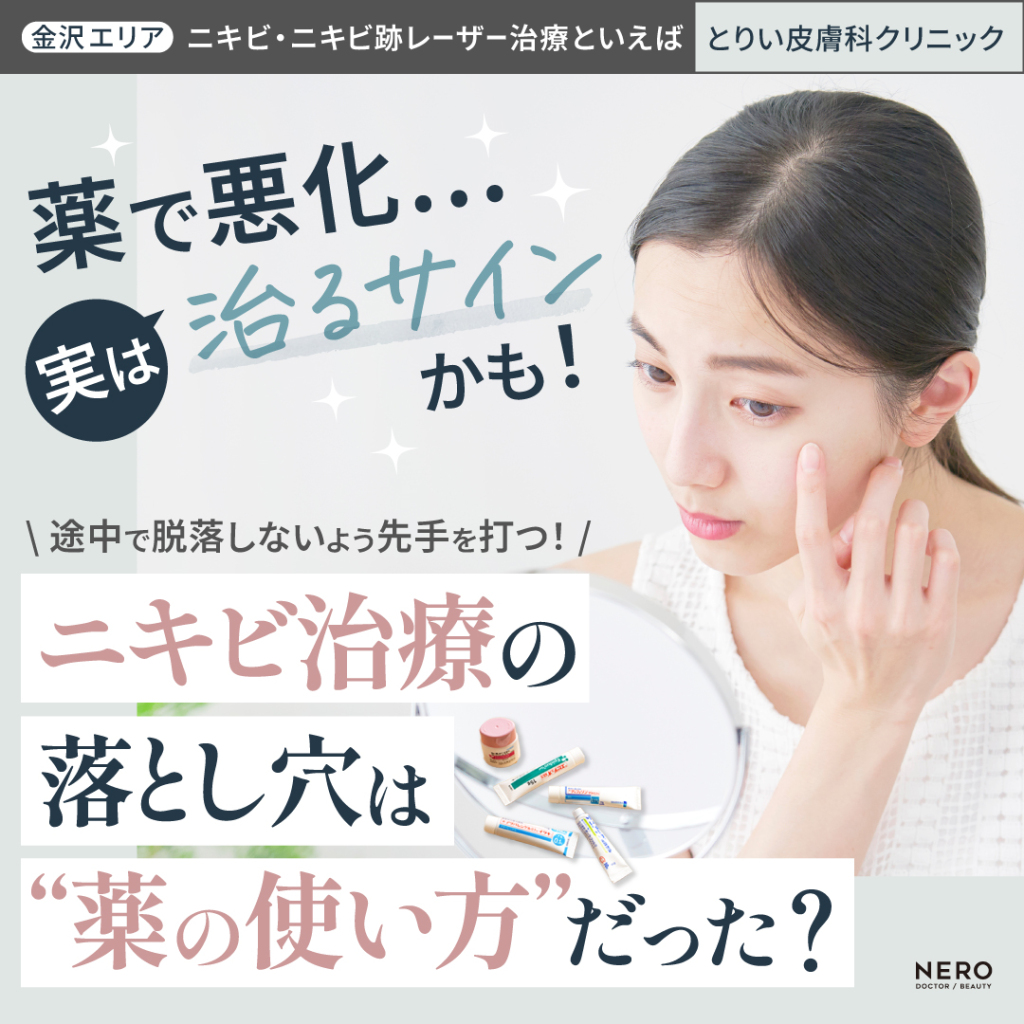 【金沢】ニキビやニキビ跡が悪化！？レーザー治療の前に知っておきたい“薬の塗り方”をニキビ治療のプロが伝授！【とりい皮膚科クリニック監修】
