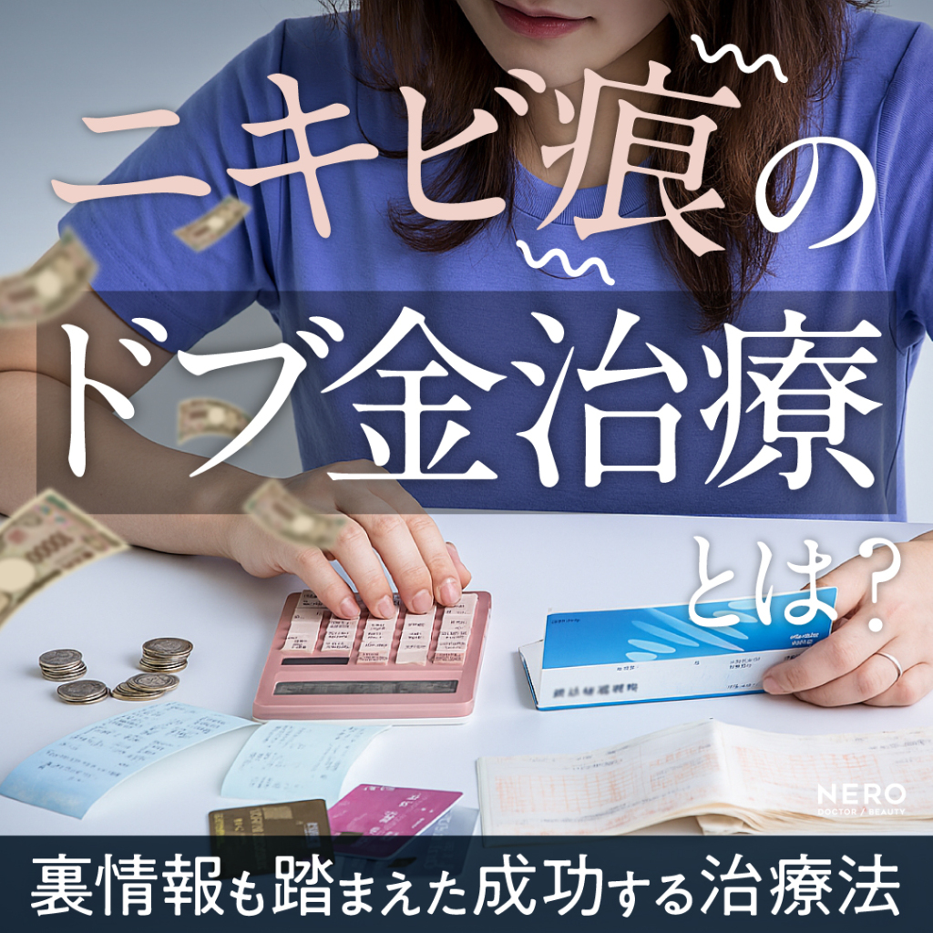 ニキビ痕のドブ金治療とは?裏情報も踏まえた成功する治療法