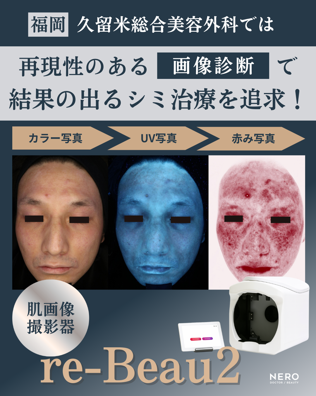 シミ取りしたのに消えない？福岡の美容外科・美容皮膚科・形成外科「久留米総合美容外科」の“結果を出す”診断力と機器力