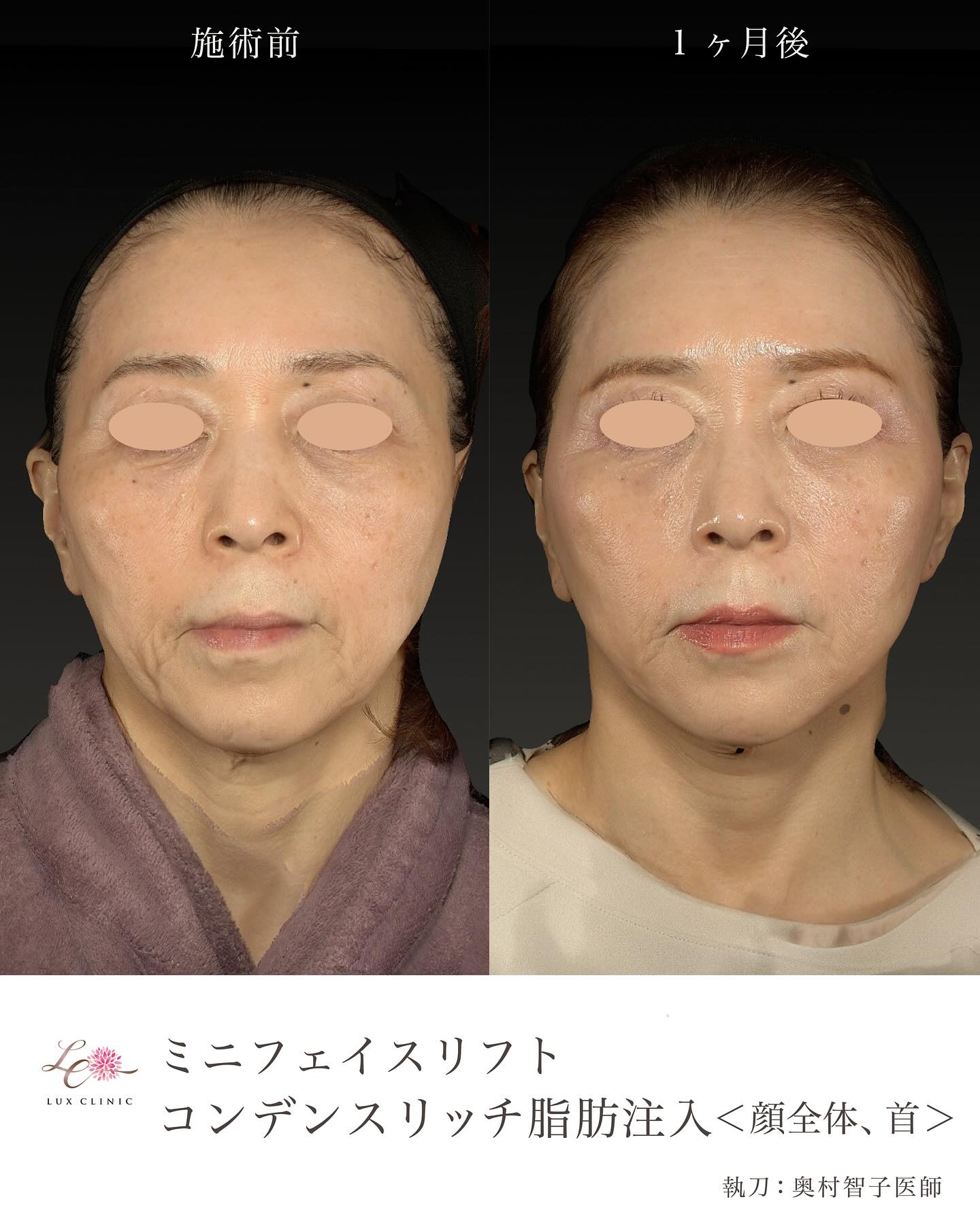 エイジングケアは何歳からでも!プロドクターが教える「引き算」の美容医療で若見えの最短ルートへ【東京・銀座 ルクスクリニック監修】