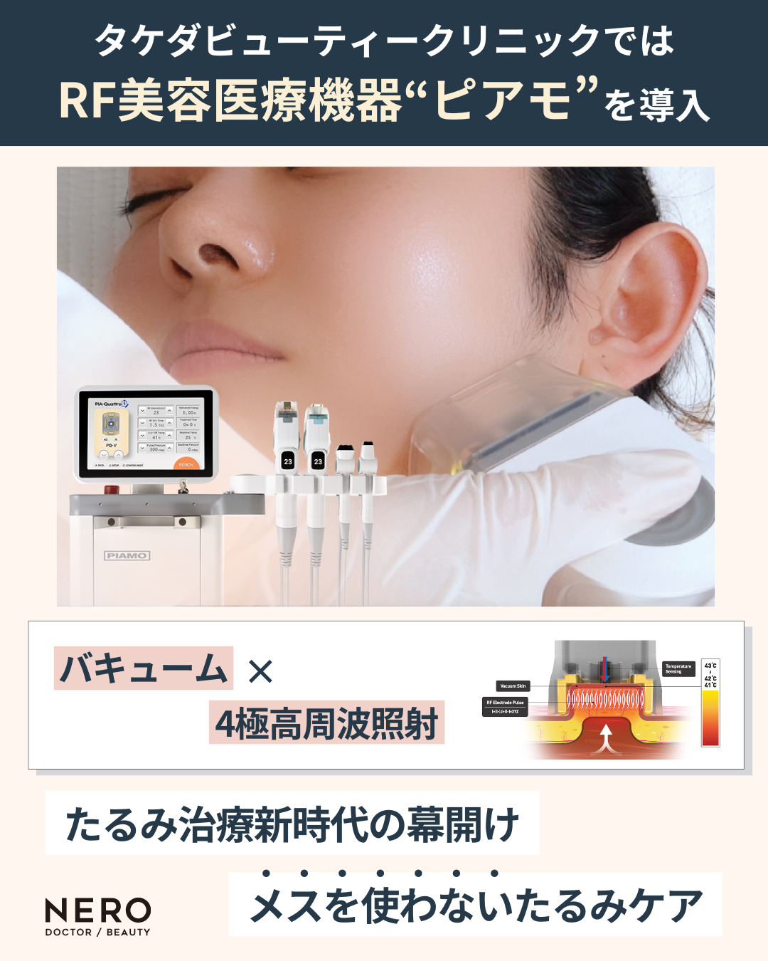 福岡で先進たるみ治療「ピアモ」 が受けられるタケダビューティークリニック！脂肪減少と肌の引き締めを同時に叶える