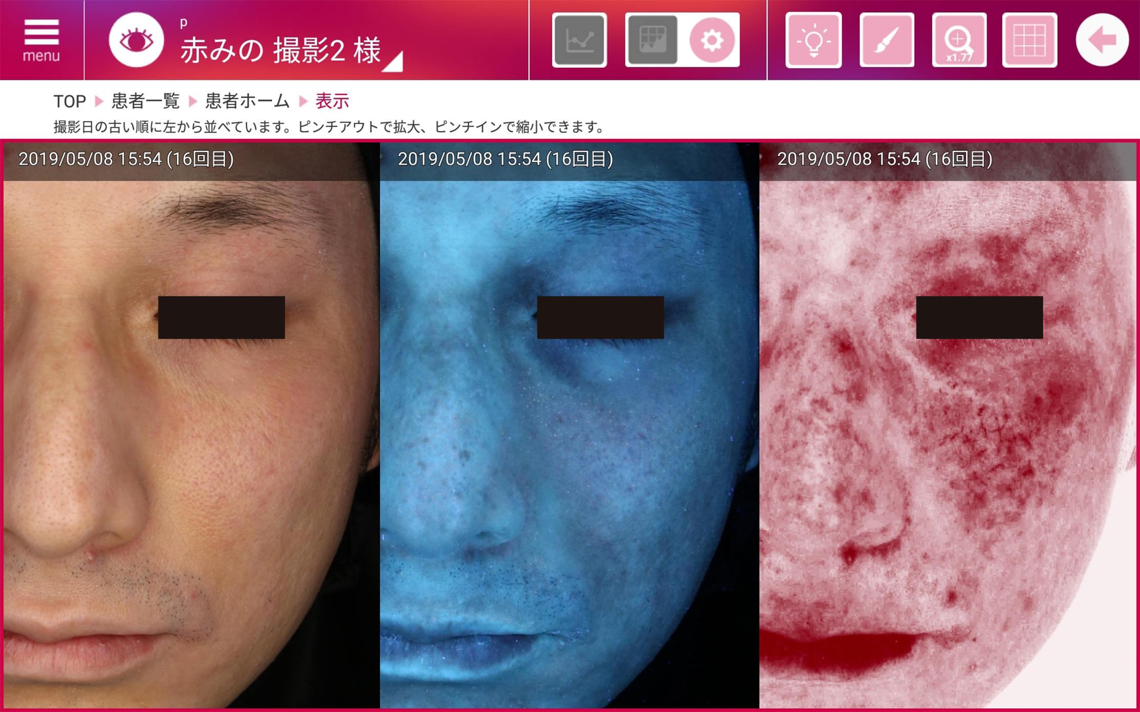 シミ取りしたのに消えない？福岡の美容外科・美容皮膚科・形成外科「久留米総合美容外科」の“結果を出す”診断力と機器力