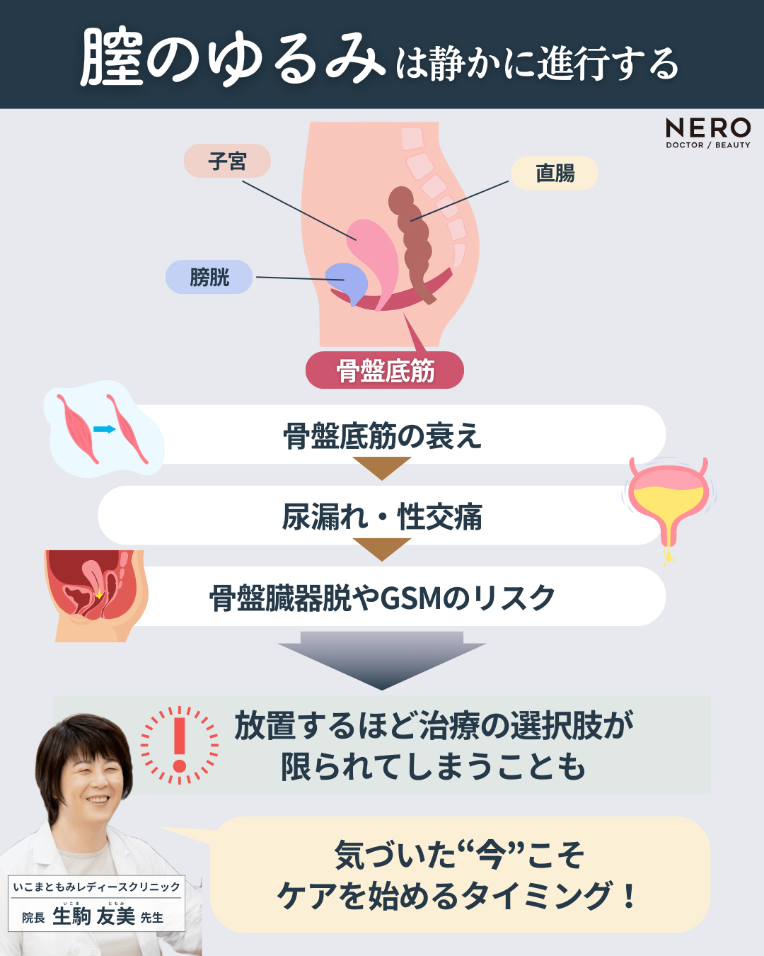 膣がゆるい…その不安、放っておくとどうなる？症状と生活への影響とは【石川】いこまともみレディースクリニック監修