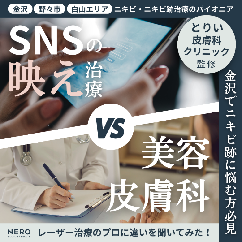 金沢でニキビ跡に悩む方へ｜レーザー治療のプロに聞いた！SNSの“映え治療”と美容皮膚科治療の違いとは？【とりい皮膚科クリニック監修】