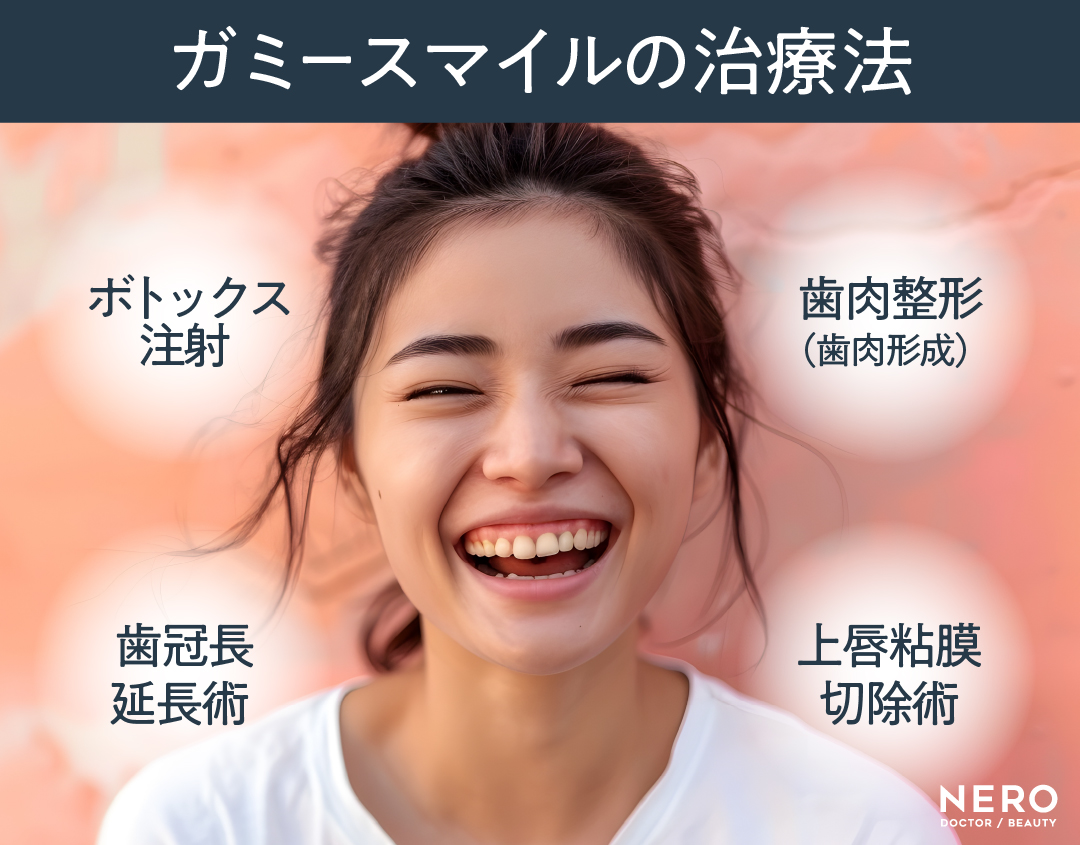 ガミースマイル　ガミースマイル治療―ボトックスから外科施術までの基礎と最新アプローチ｜NERO DOCTOR / BEAUTY（美容医療）