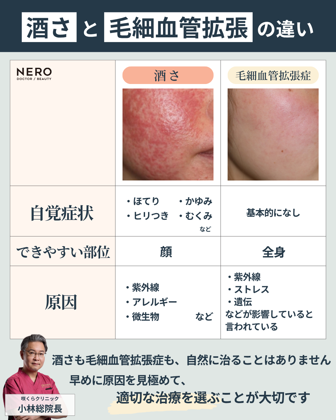顔の赤みの原因は？“見た目だけ”で判断しない、正しい診断が改善への一歩