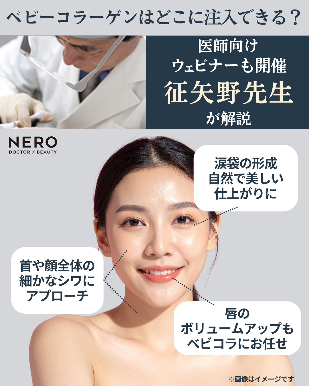 ヒト胎盤由来コラーゲン「ベビーコラーゲン」が選ばれる理由｜自然なハリとツヤを叶える新世代コラーゲン注入