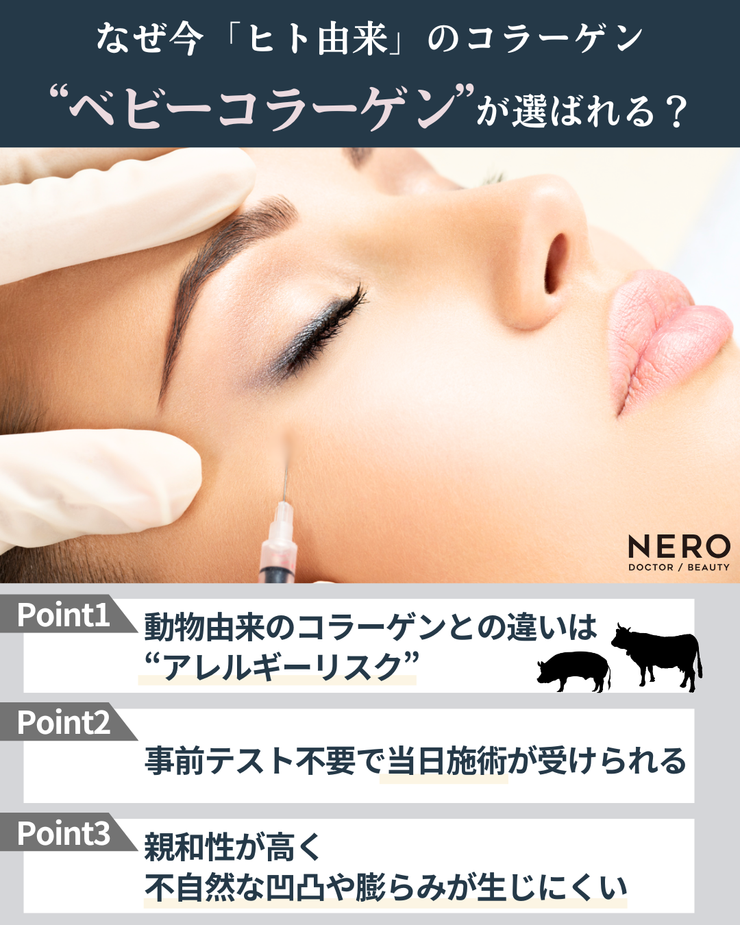 ヒト胎盤由来コラーゲン「ベビーコラーゲン」が選ばれる理由｜自然なハリとツヤを叶える新世代コラーゲン注入