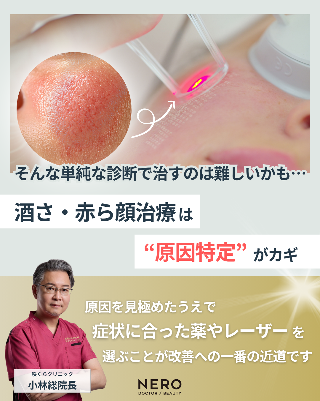 顔の赤みの原因は？“見た目だけ”で判断しない、正しい診断が改善への一歩