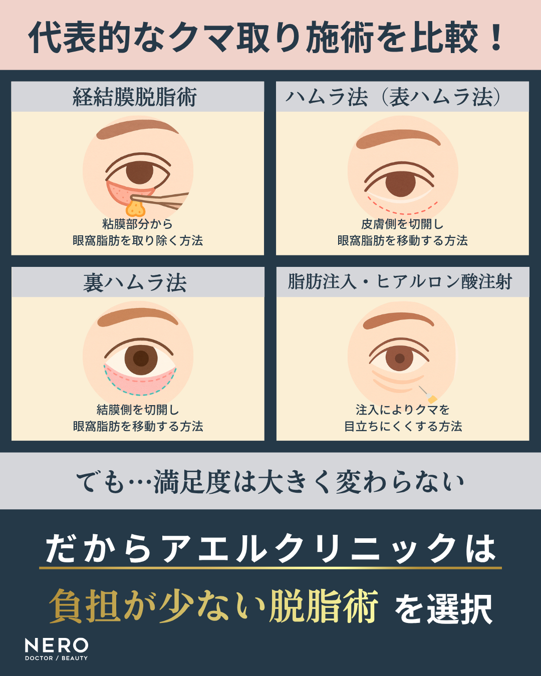 クマ取りのおすすめは?経結膜脱脂術で痛み・腫れを抑えるアエルクリニックのこだわりとは