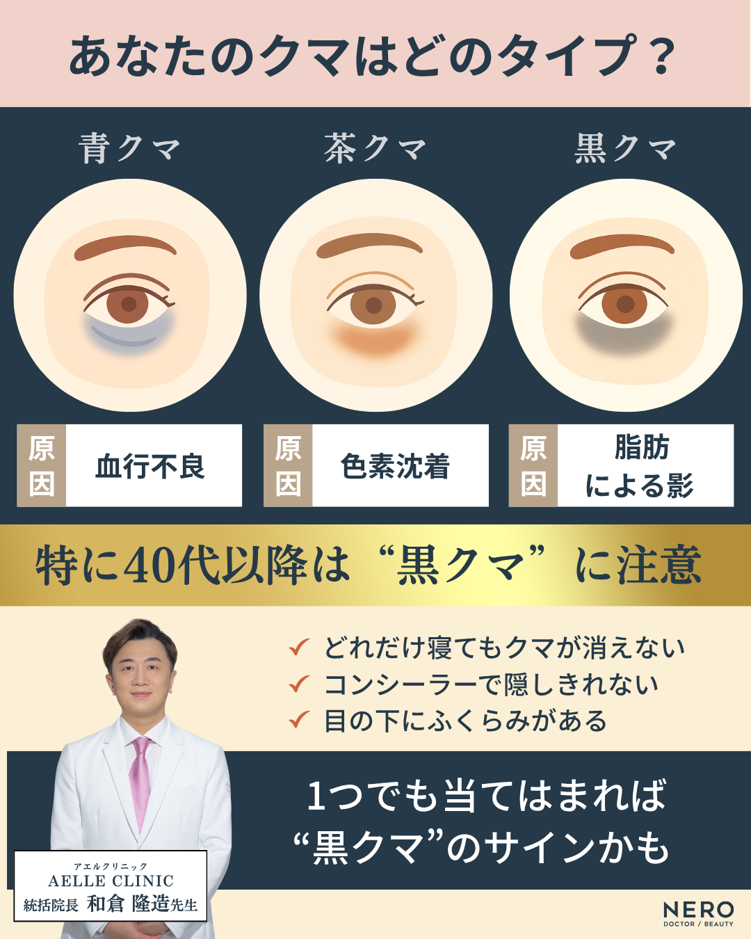 クマ取りのおすすめは?経結膜脱脂術で痛み・腫れを抑えるアエルクリニックのこだわりとは