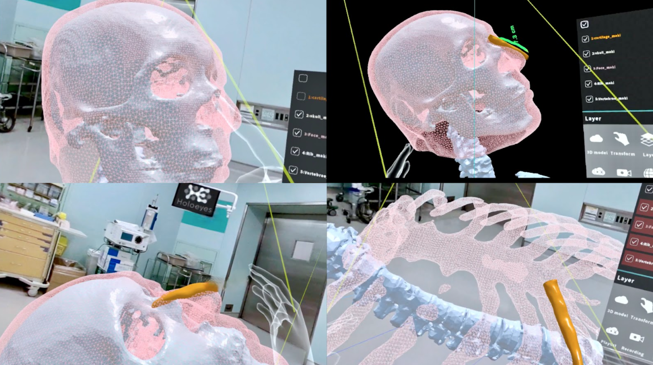 【第48回日本美容外科学会総会（JSAPS）】招待講演に迫る― VR/AR/MR/XRで変わる外科医療の現場と、空間コンピューティングが描く手術アシストの未来図