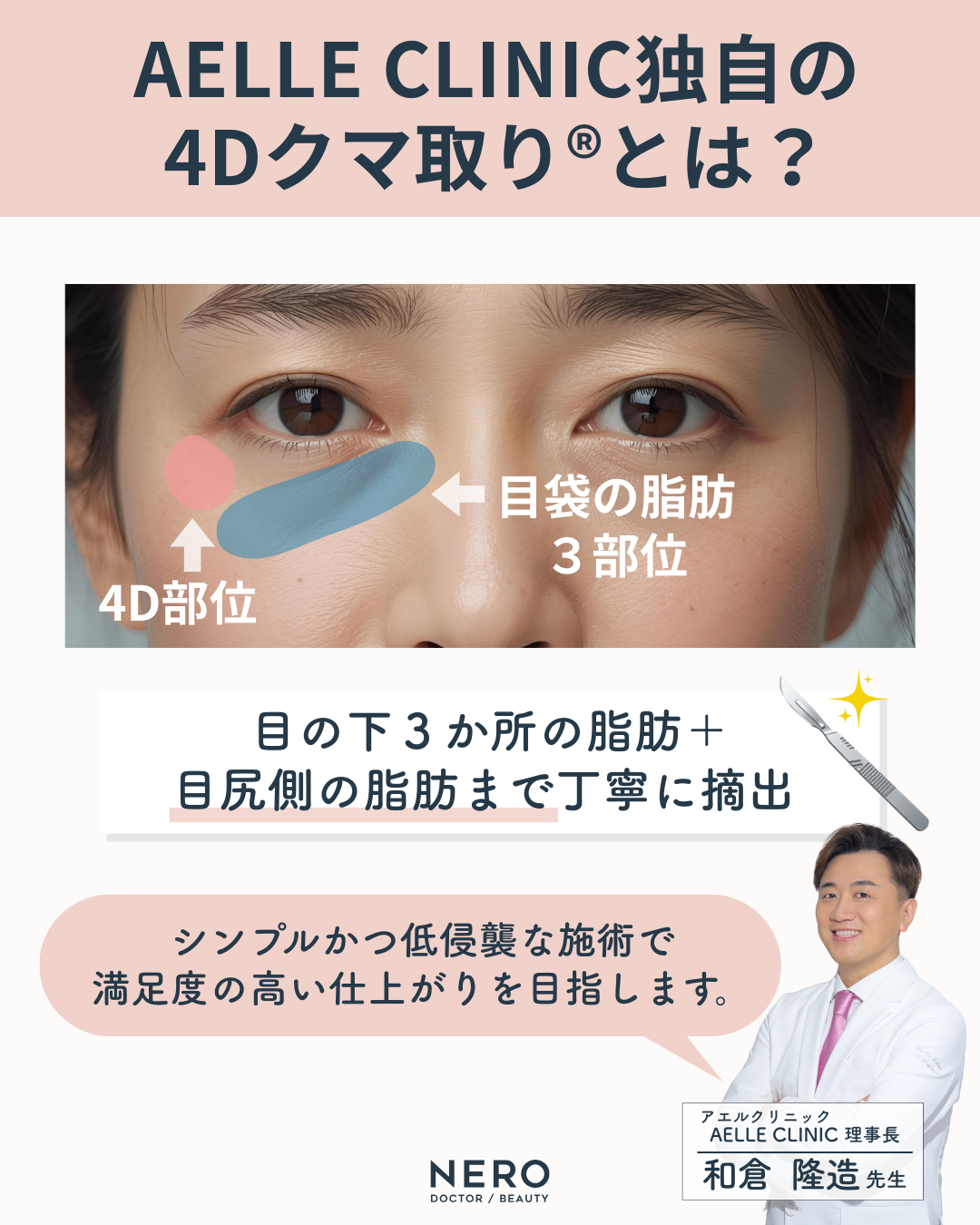 目の下の脂肪取りで顔の印象を変える！アエルクリニックの提案する4Dクマ取り®という選択肢