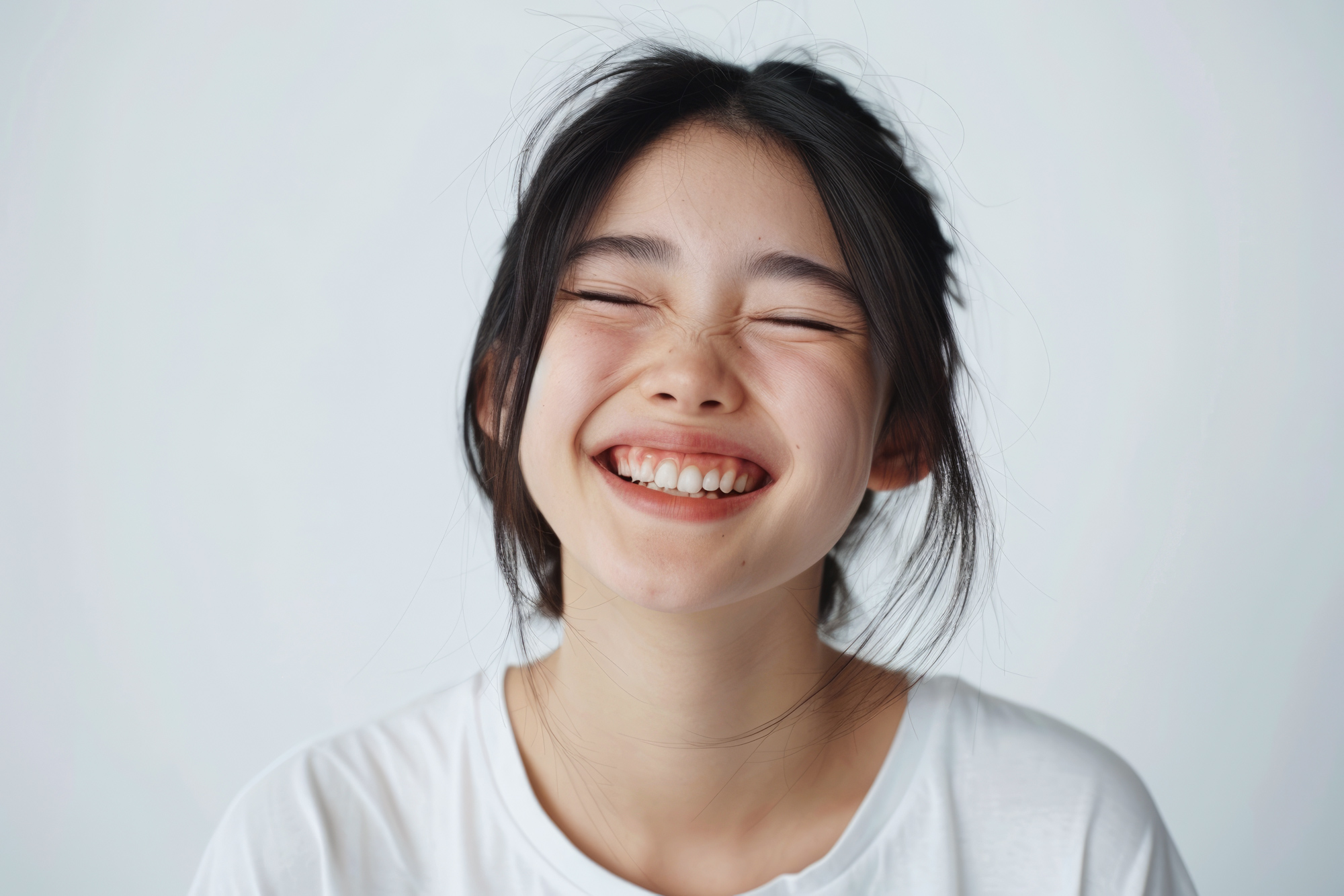 ガミースマイル　笑顔　ガミースマイル治療―ボトックスから外科施術までの基礎と最新アプローチ｜NERO DOCTOR / BEAUTY（美容医療）