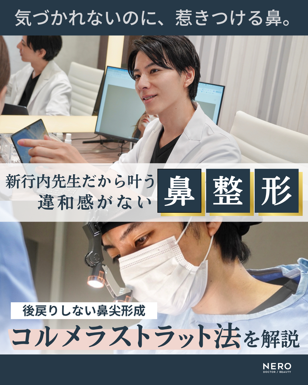 鼻先が丸くてコンプレックス…“ちょっと整えるだけ”でここまで変わる自然な印象｜東京・渋谷区LIVIN CLINIC監修