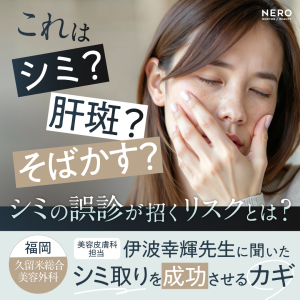 シミ取りの成功は正しい診断が鍵！福岡・久留米総合美容外科（美容外科・形成外科・美容皮膚科）監修
