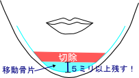 骨切り・脂肪吸引など「輪郭形成で骨格はどこまで変えられる?」名医のSNSは「チャンピオン症例だらけ!?」と驚くかも。“衝撃ビフォーアフター”をチェック|NERO DOCTOR / BEAUTY(美容医療)