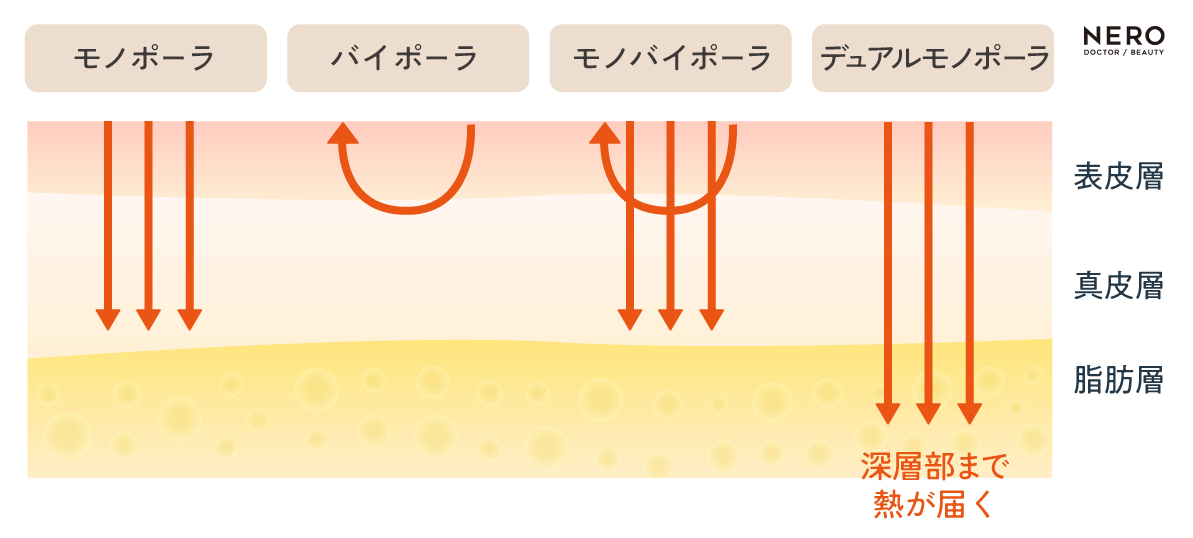 2025年RF戦国時代！MHz、モノ・バイ、冷却機能から読み解く「賢いたるみ治療」の選び方｜NERO DOCTOR / BEAUTY（美容医療）