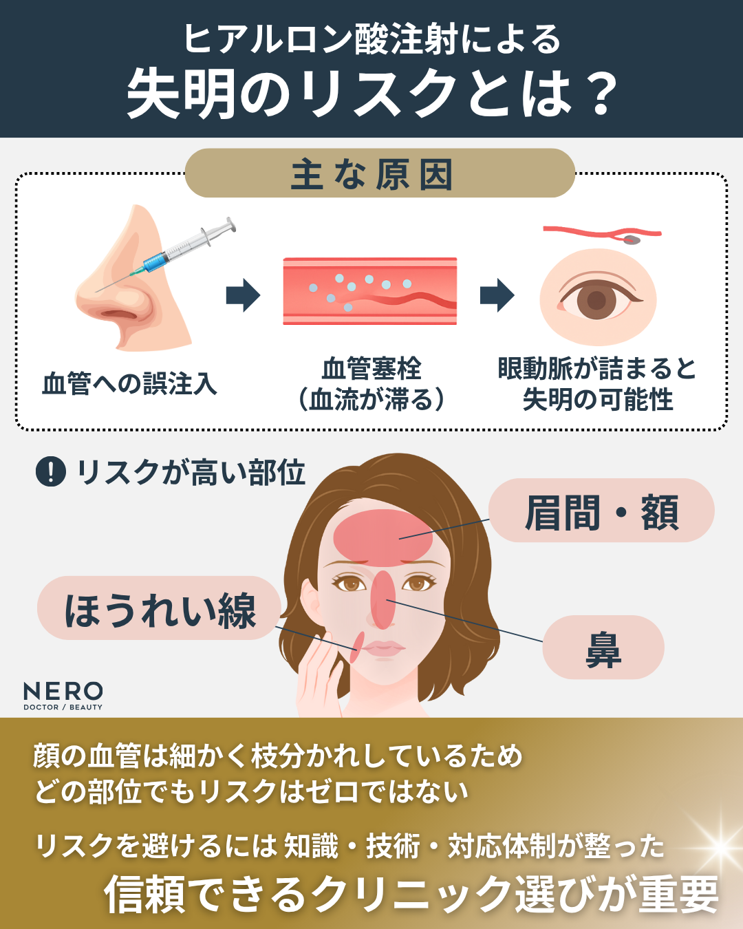 ビアンカクリニックに聞く美容医療のリアル!ヒアルロン酸注射に失明リスクがあるって本当?