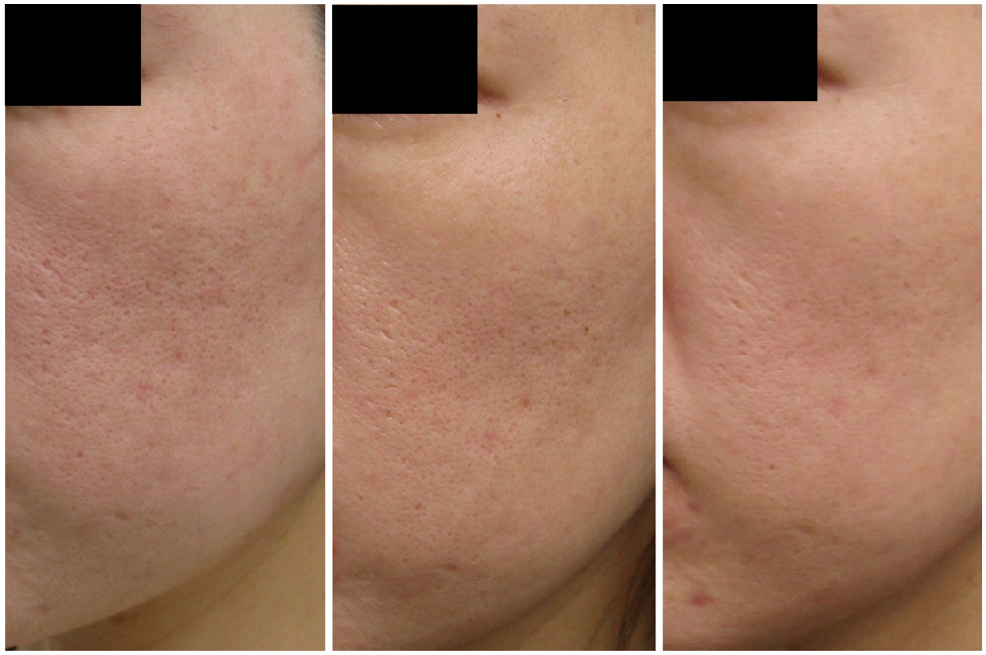 【肌質改善・福岡】タケダビューティークリニックで真の健康と美しさの持続性を叶える