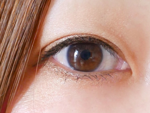 末広二重と奥二重の違いは？自然なぱっちり二重になりたいときはどうする？