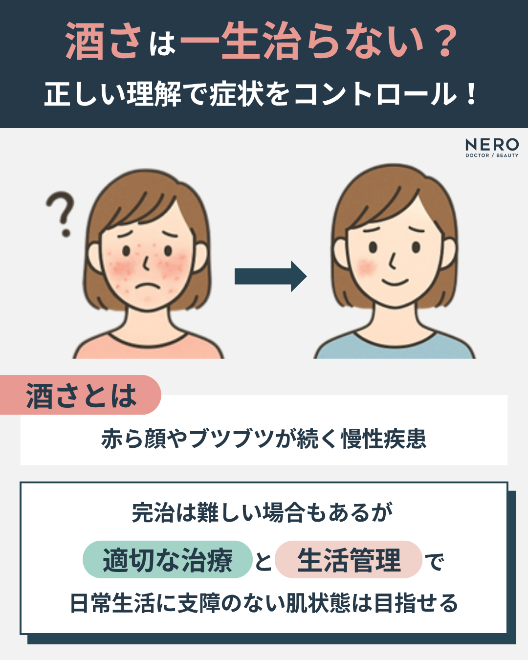 酒さは一生治らない？治療後も続く赤み…再発防止のカギは“正しい診断”！