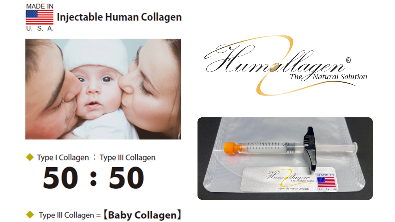 ヒト胎盤由来コラーゲン「ベビーコラーゲン」が選ばれる理由｜自然なハリとツヤを叶える新世代コラーゲン注入