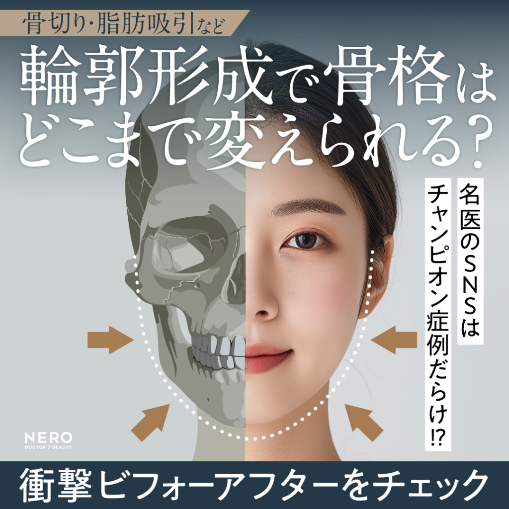 骨切り・脂肪吸引など「輪郭形成で骨格はどこまで変えられる？」名医のSNSは「チャンピオン症例だらけ！？」と驚くかも。“衝撃ビフォーアフター”をチェック
