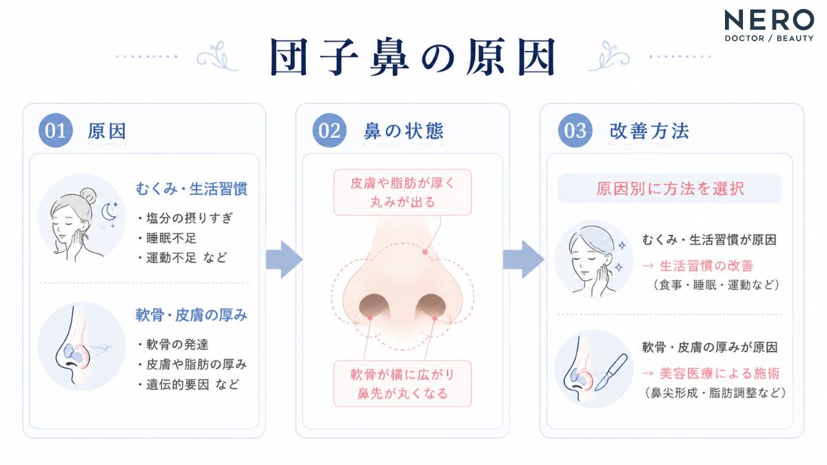 団子鼻の原因と改善方法の流れをまとめた図