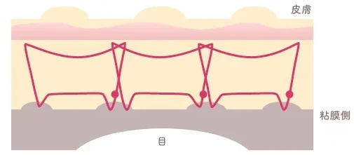 二重埋没法、取れるって本当?“取れにくさ”のカギと対策をプロが解説【HAABクリニック 田中統括院長監修】