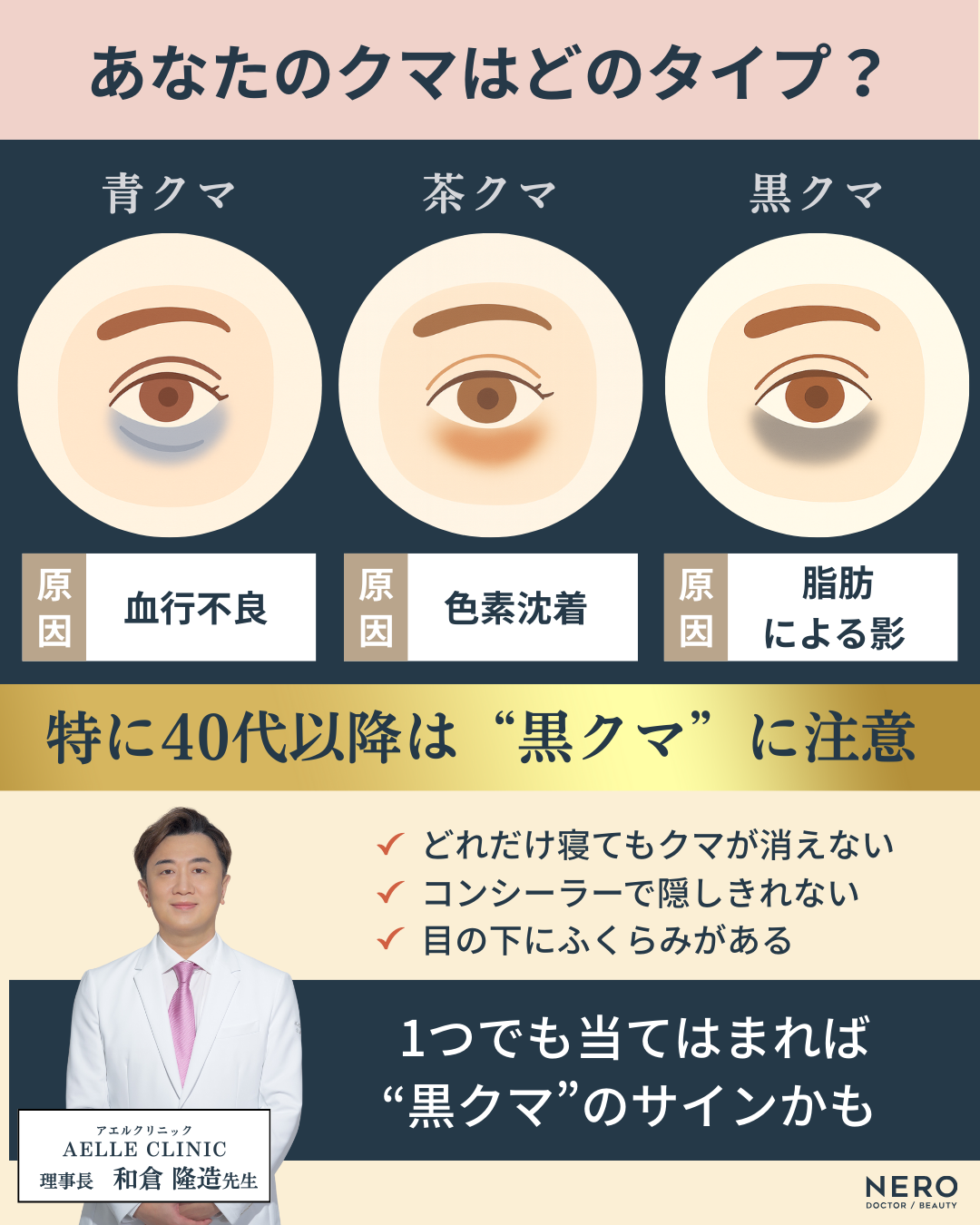 クマ取りのおすすめは?経結膜脱脂術で痛み・腫れを抑えるアエルクリニックのこだわりとは