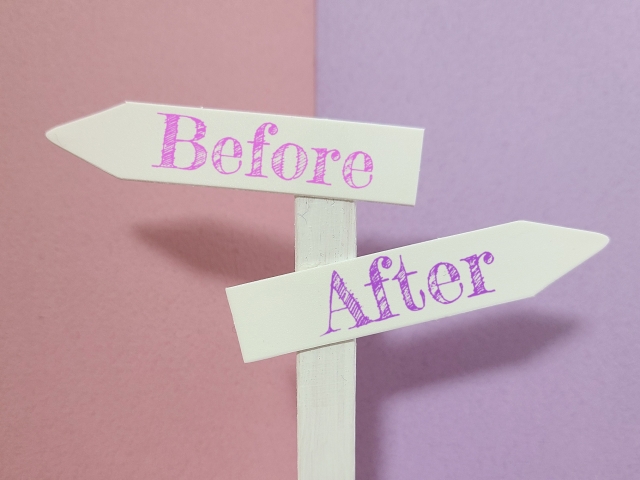 beforeとafterイメージ タレ目形成で涙袋がなくなるって本当?見え方が変わる仕組みと温存方法|NERO DOCTOR / BEAUTY(美容医療)