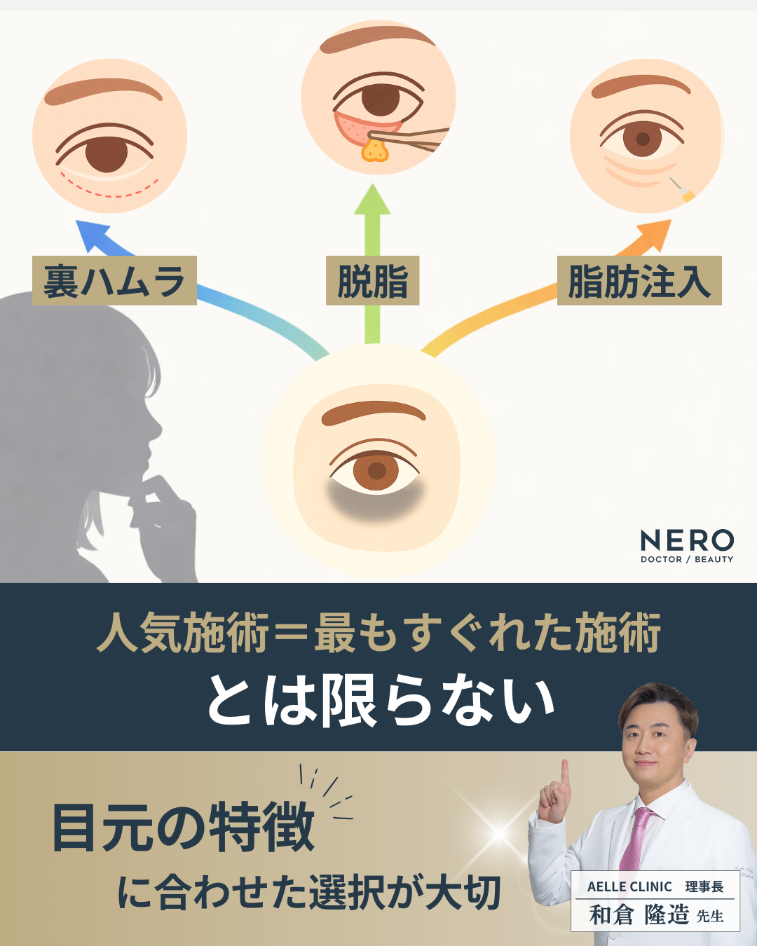 【クマ取りにおすすめの施術】人気だけで選ばない！本当に合う方法の見極め方【アエルクリニック監修】