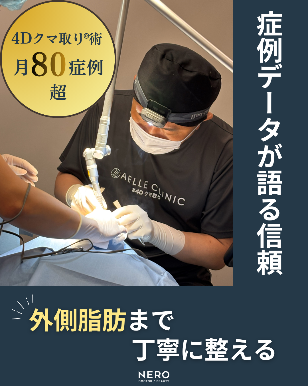 【クマ取りにおすすめの施術】人気だけで選ばない！本当に合う方法の見極め方【アエルクリニック監修】