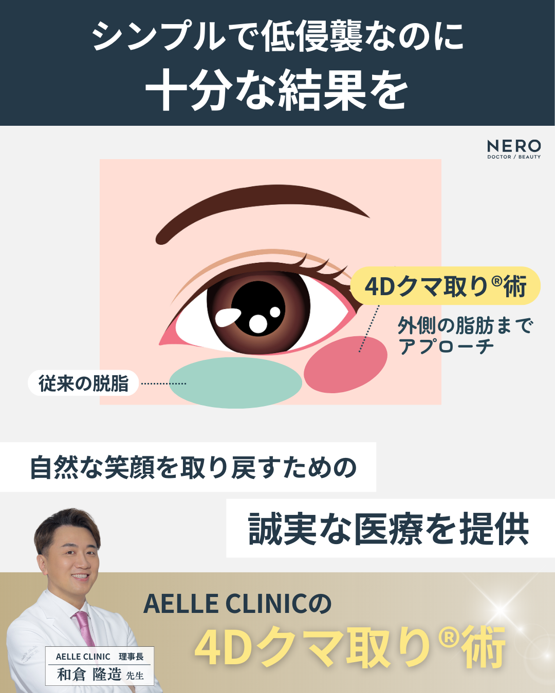目の下の脂肪取りで失敗しないために。切らずに自然に整える、アエルクリニックの理想のクマ取り