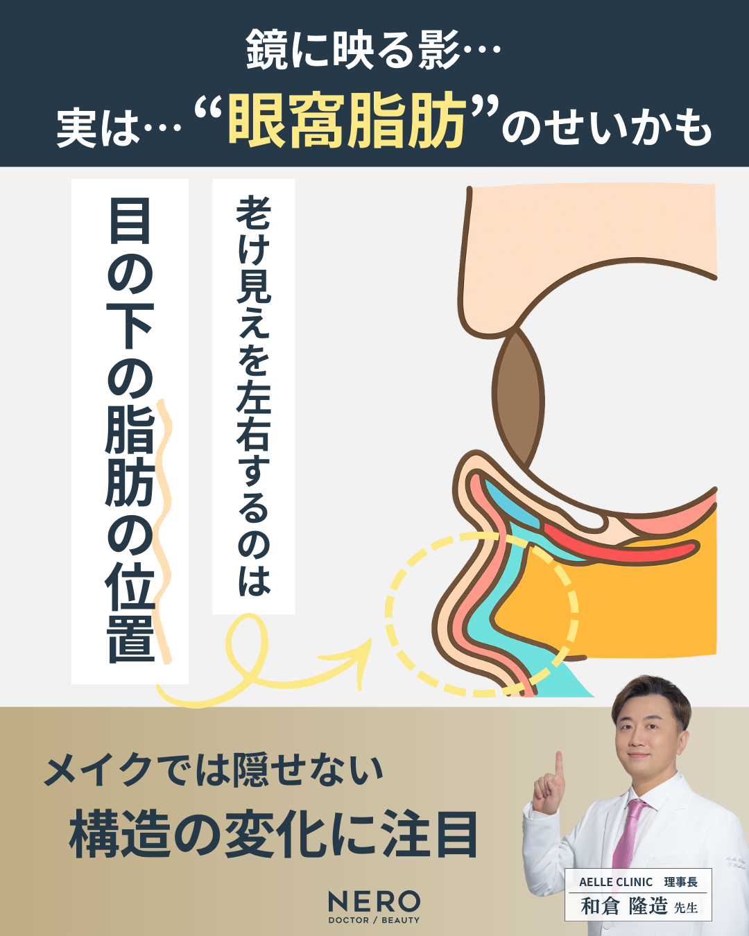 目の下の脂肪取りで失敗しないために。切らずに自然に整える、アエルクリニックの理想のクマ取り