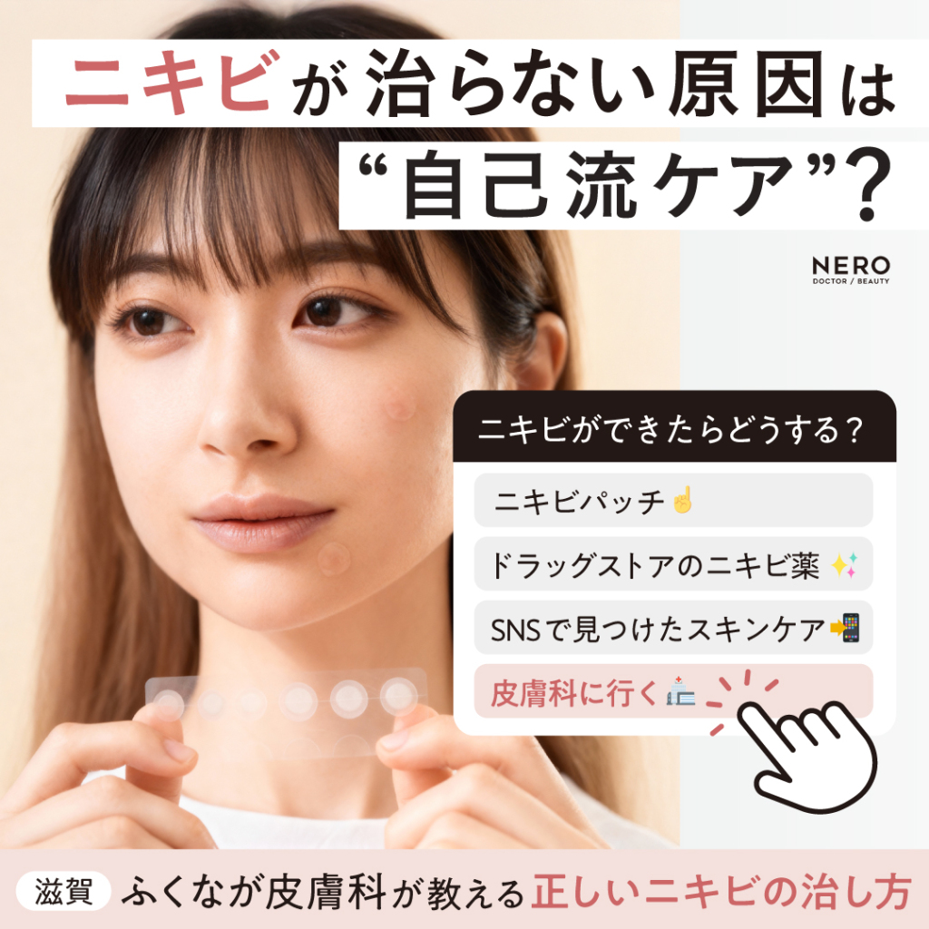 ニキビの治し方を滋賀・ふくなが皮膚科に聞いた！皮膚科専門医が解説するあなたのニキビが治らない理由と正しいアプローチ