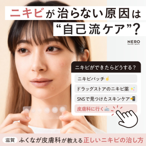 ニキビの治し方を滋賀・ふくなが皮膚科に聞いた！皮膚科専門医が解説するあなたのニキビが治らない理由と正しいアプローチ