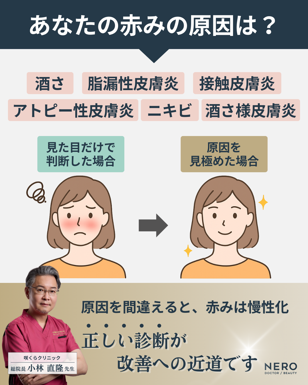 顔の赤みの原因を見極めて治す!酒さ・ニキビ・アトピー…症状別治療法まとめ