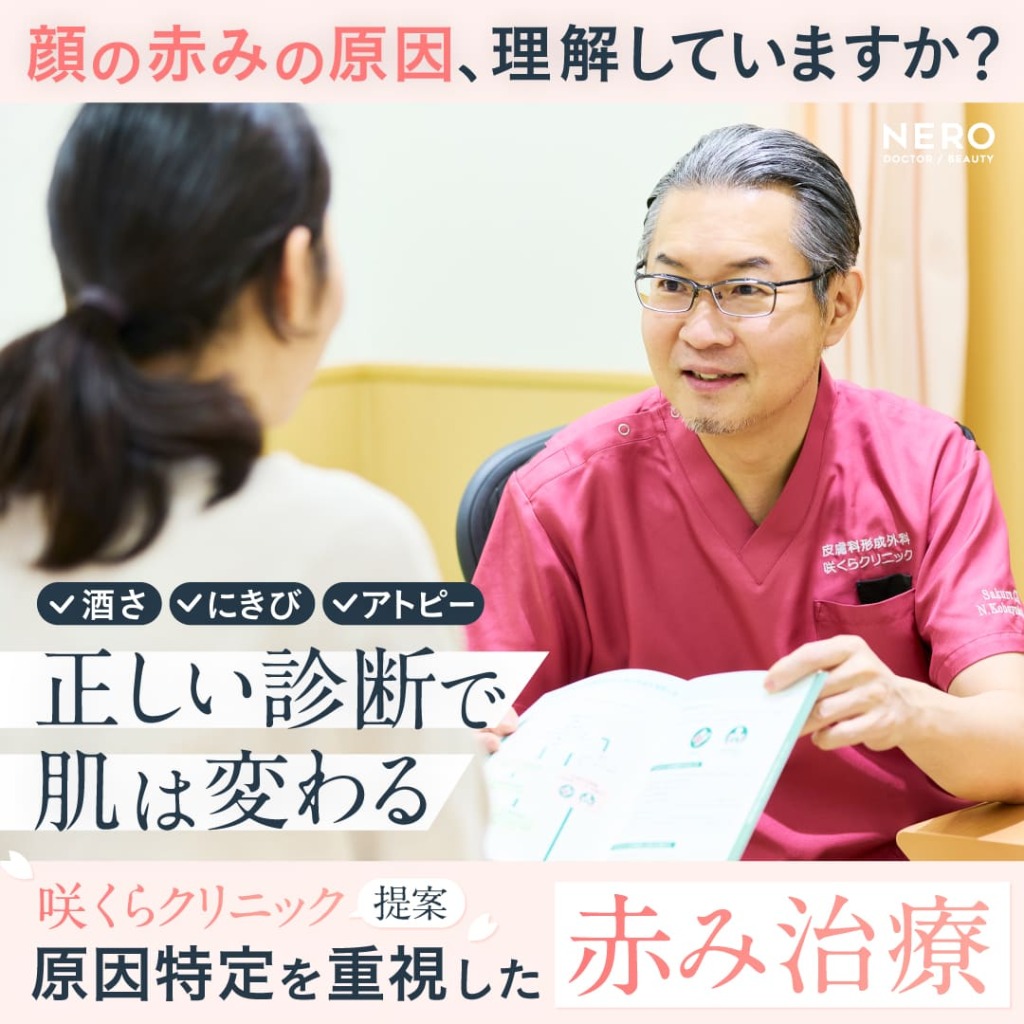 顔の赤みの原因を見極めて治す！酒さ・ニキビ・アトピー…症状別治療法まとめ