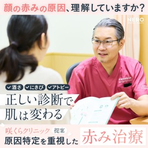 顔の赤みの原因を見極めて治す！酒さ・ニキビ・アトピー…症状別治療法まとめ