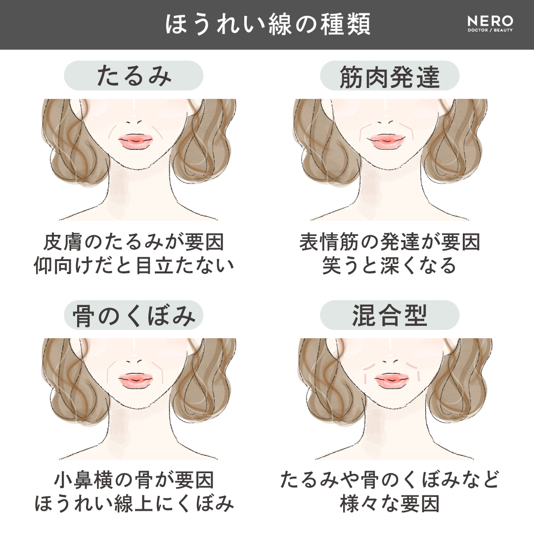 “線”ではなく“構造”―鼻翼基部ヒアルロン酸・貴族手術・ジュブゼンでのアプローチとは