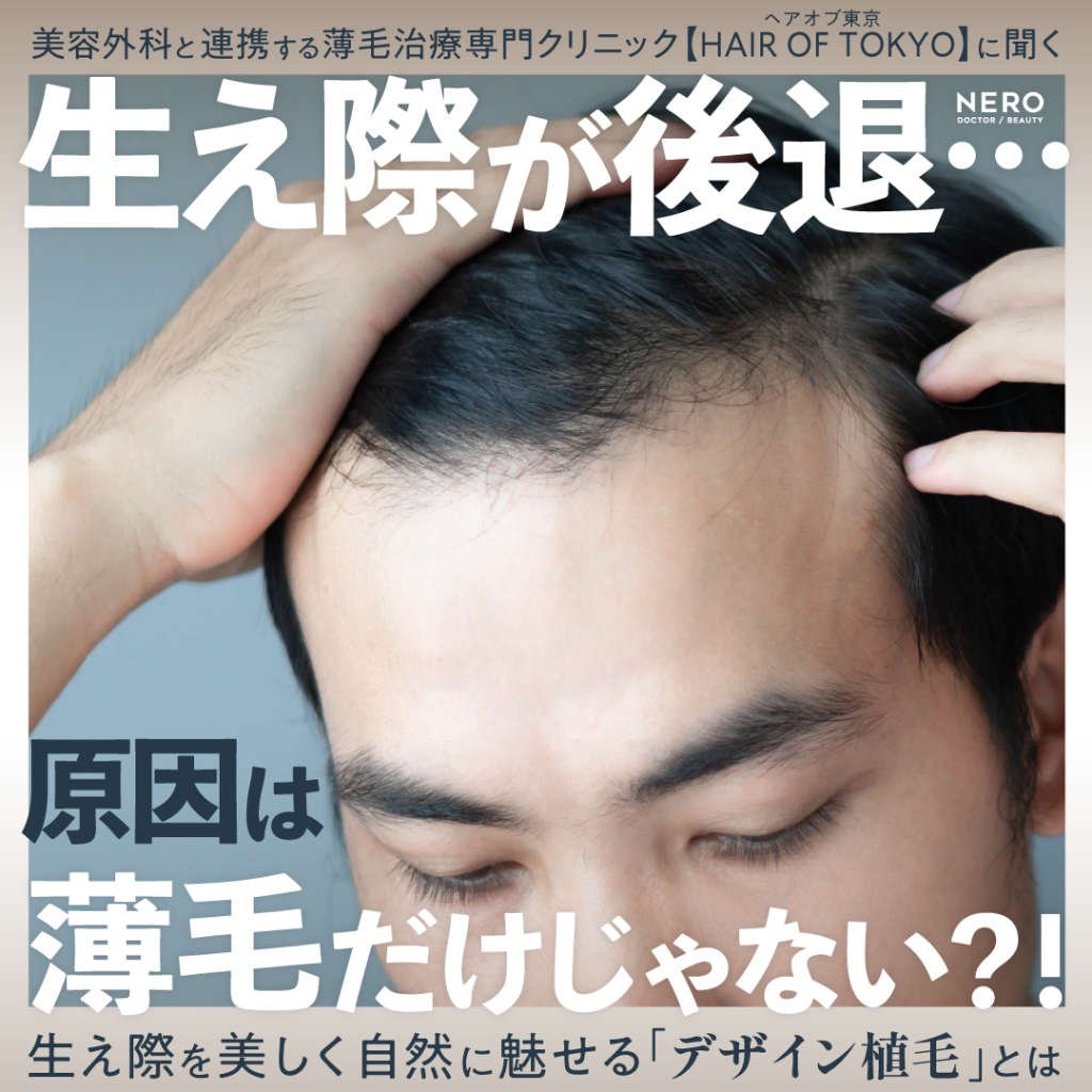 生え際後退の原因は薄毛だけじゃない？薄毛治療専門クリニック【ヘアオブ東京】に聞く“自然で美しいデザイン植毛”とは