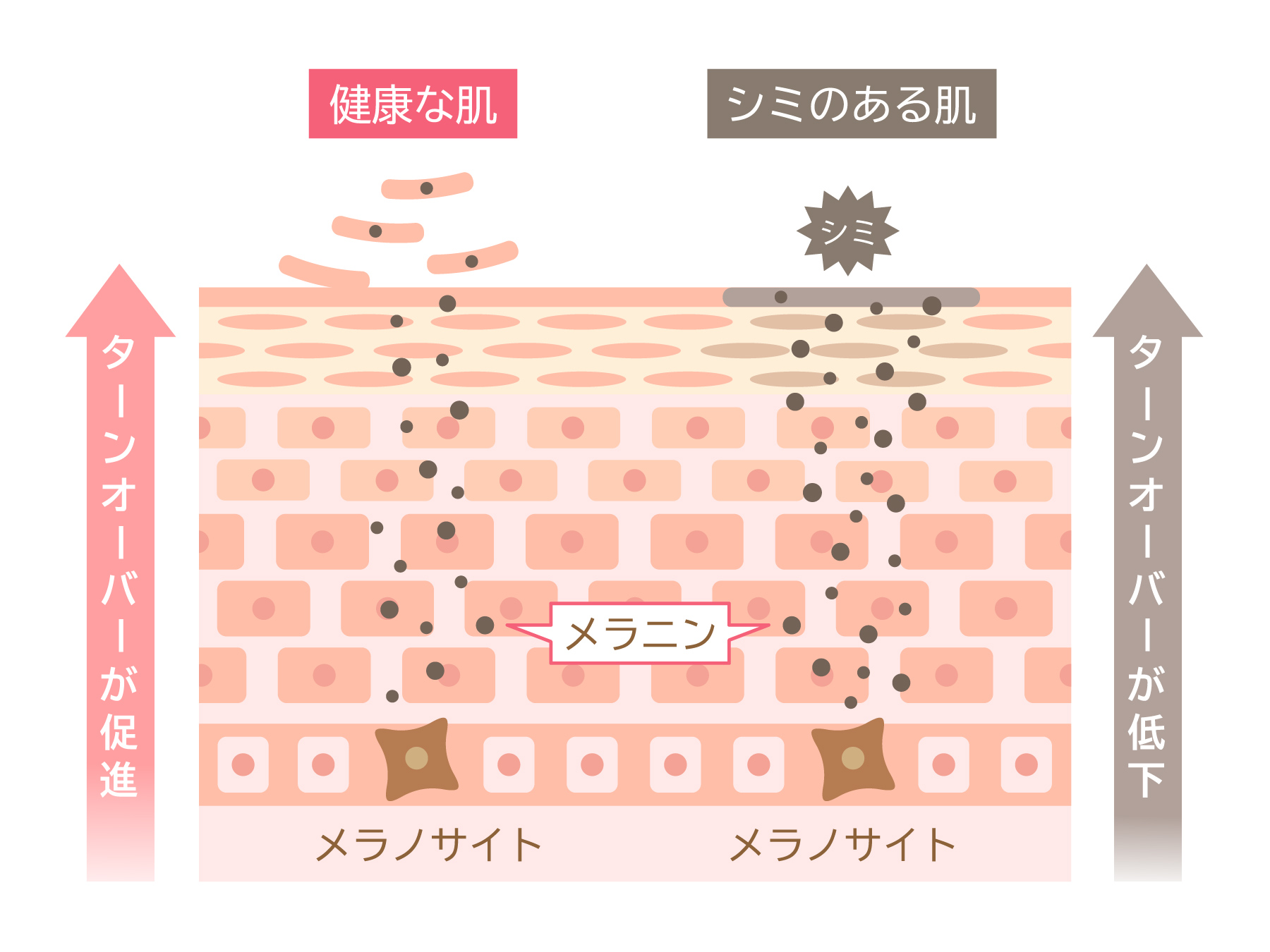 シミ取りに行く前の教科書—PIH（炎症後色素沈着）を防ぐために知るべきこと｜NERO DOCTOR / BEAUTY（美容医療）