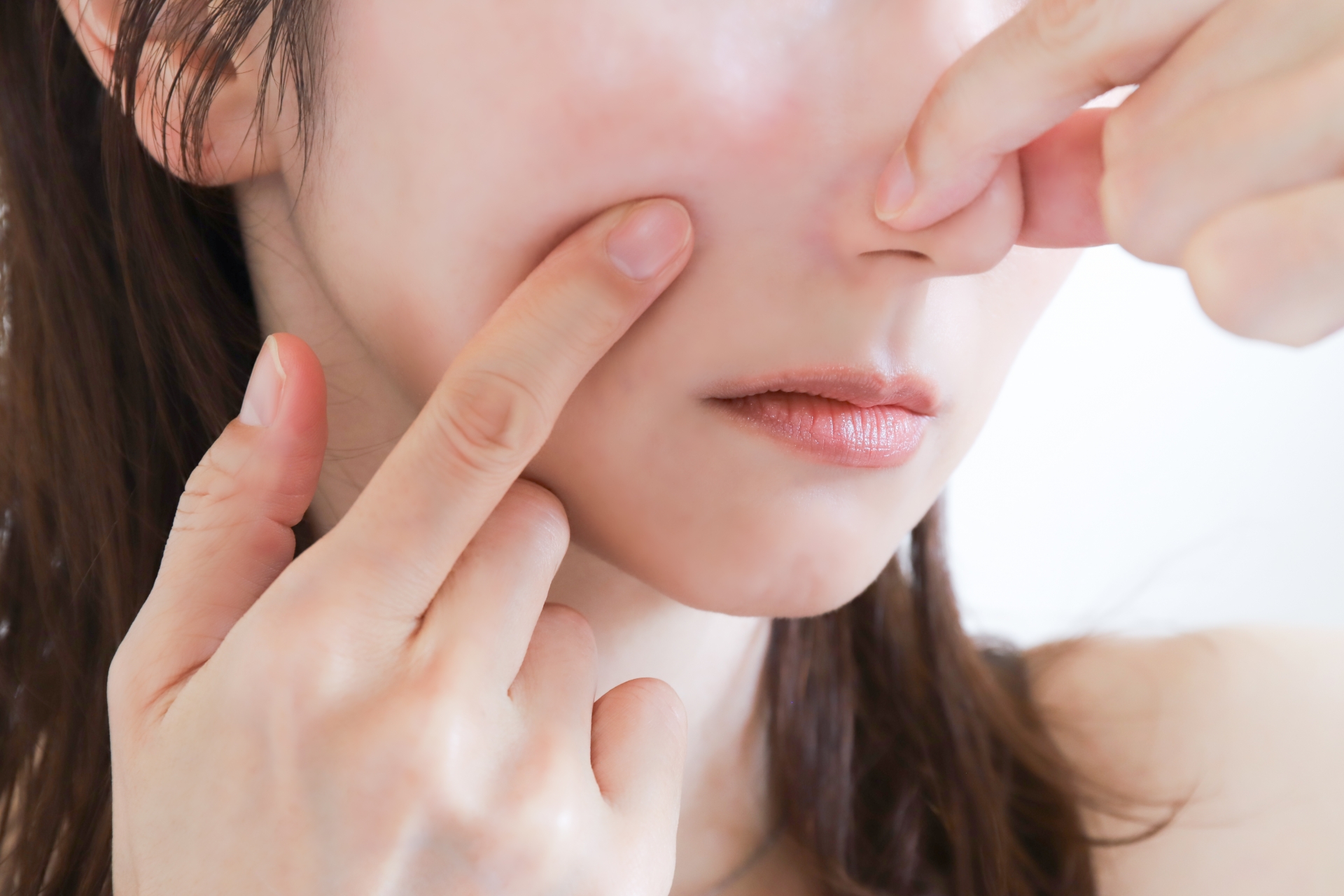 毛穴を気にする女性 アドバテックスレーザーとは?赤ら顔・ニキビ痕・毛穴にアプローチするデュアルレーザー|NERO DOCTOR / BEAUTY(美容医療)