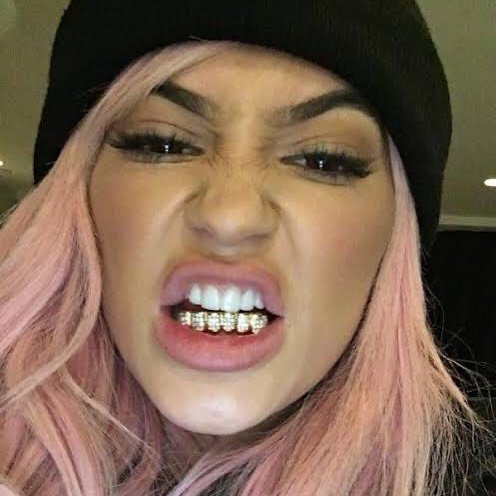 Kylie Jenner　ビフォーアフター動画には罠がある！？【私、○○千万かけました】YouTuber・インフルエンサーの美容医療の見方｜NERO DOCTOR / BEAUTY（美容医療）