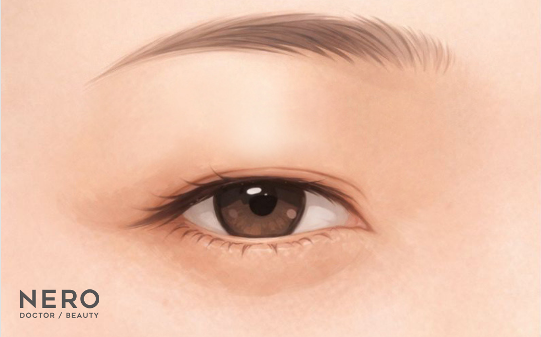まぶたのたるみ取りは埋没だけじゃ限界?埋没と切開どっちがいいか悩む方に…ナチュラルな二重切開という新しい選択肢【オーキッド美容クリニック東京御徒町】