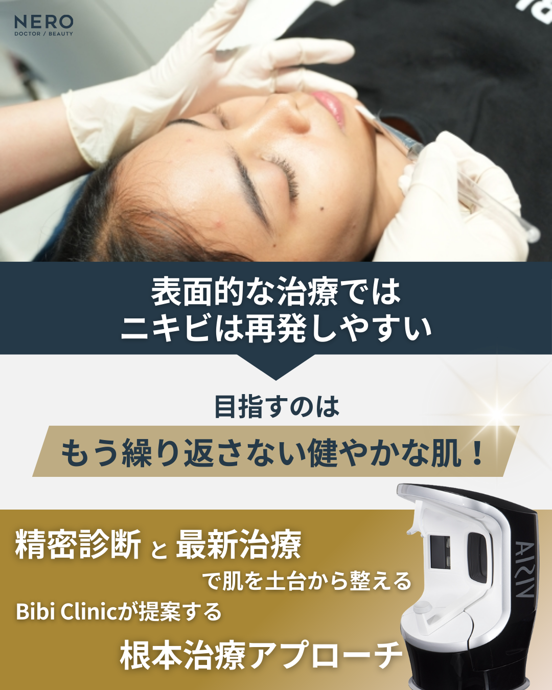 バンコクでニキビ・ニキビ痕を治療するなら―Bibi Clinicが提案する“繰り返さない肌”への最短ルート